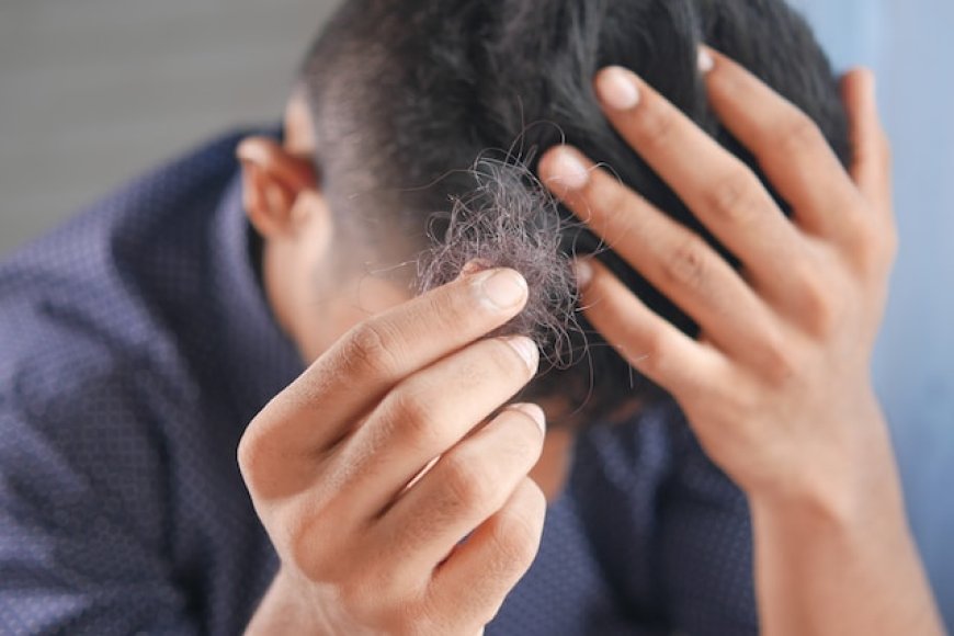 Is stress causing hair loss?